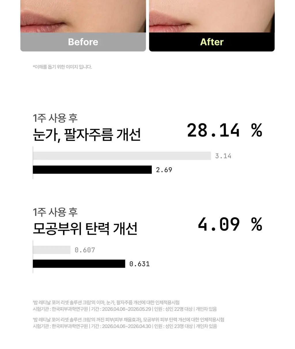 [웬디PICK] 포들 밤 레티날 모공 리셋 솔루션 캡슐 크림 55g 상세페이지 25